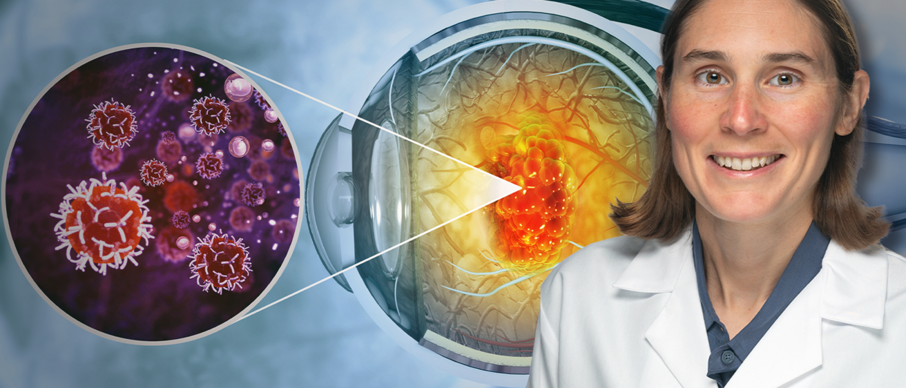 Dr. Elaine Binkley Ocular OPncology