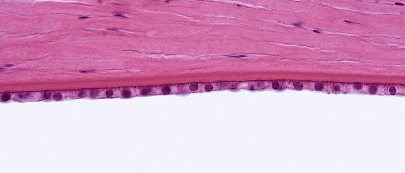 Endothelial Cornea Cells