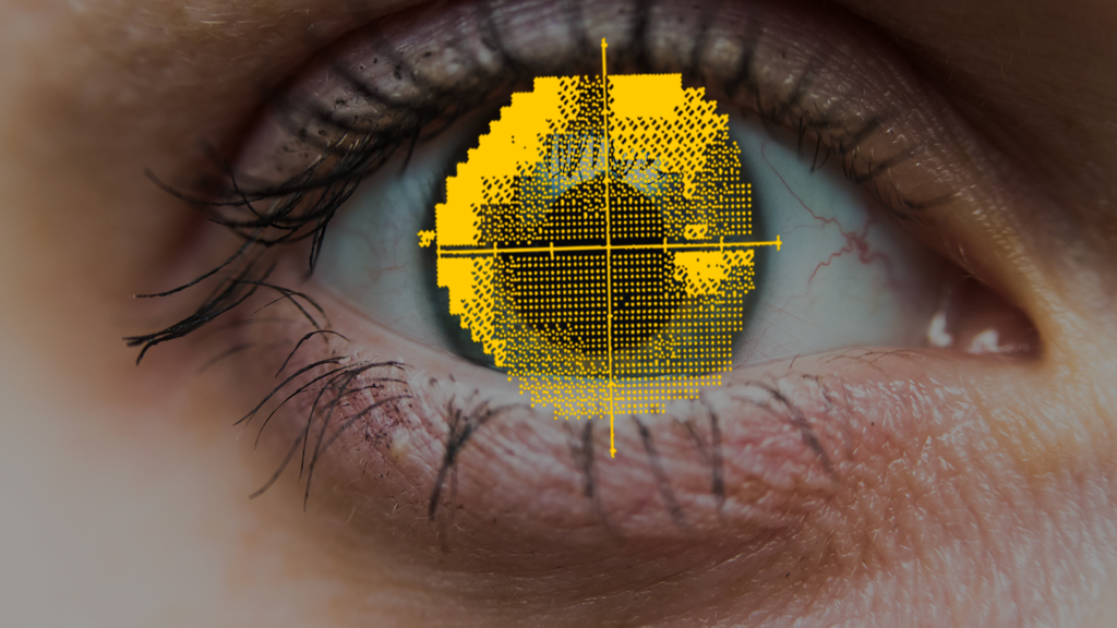 visual field results over eye