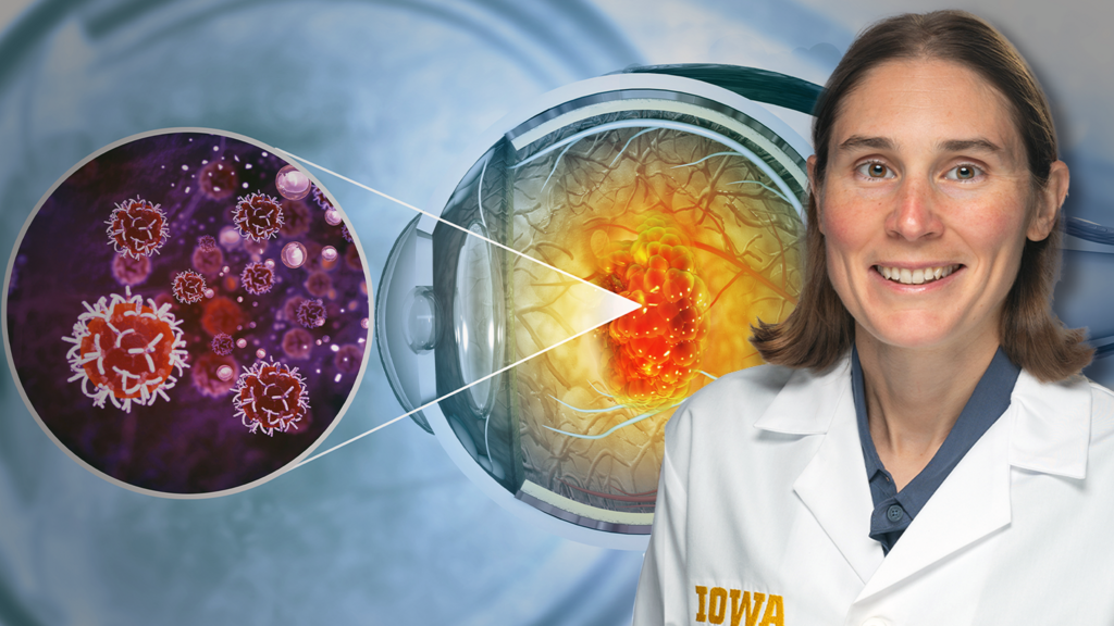 Dr. Elaine Binkley Ocular OPncology